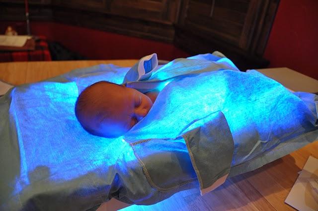 Фототерапия новорожденных в домашних условиях