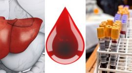 Печеночные показатели биохимического анализа крови: нормы