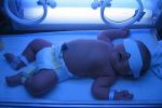 Лечение желтушки под лампой: фотолампа для новорожденных