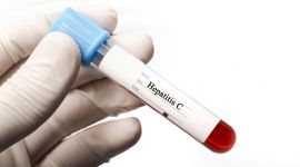 Ложноположительный анализ на гепатит С: ошибочный тест