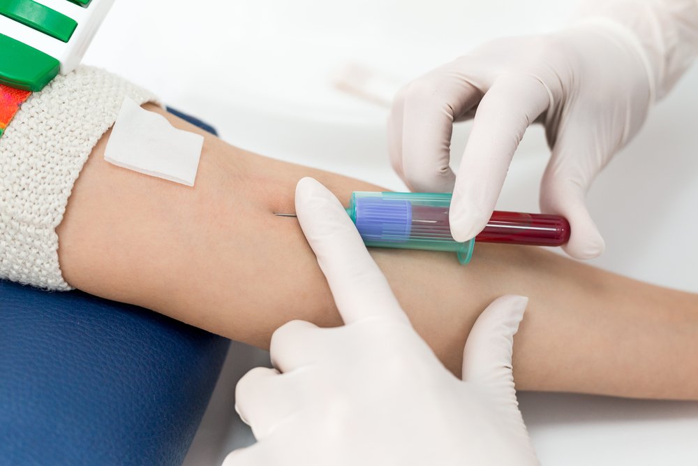 Как делают анализ крови HBsAg