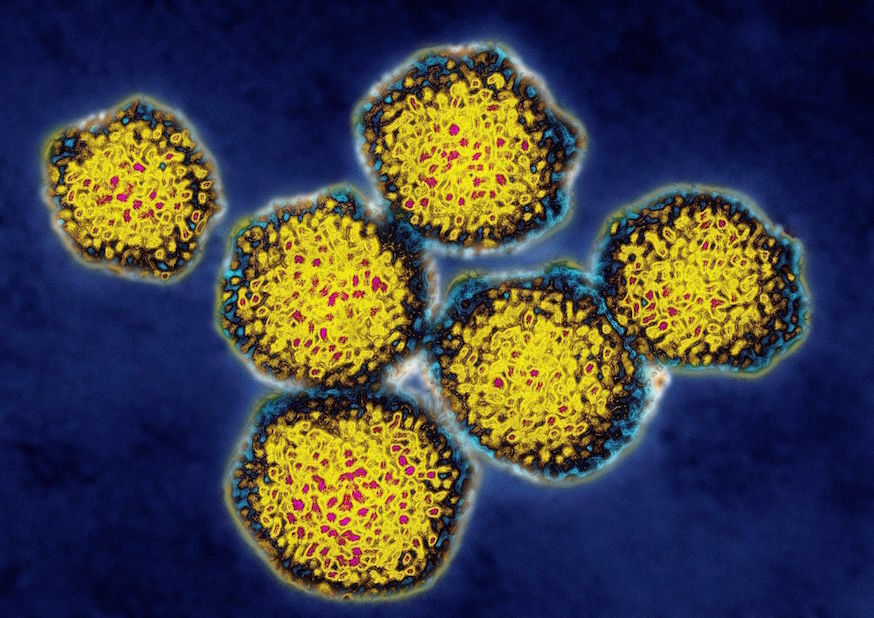 Норма количественного исследования РНК вируса гепатита С