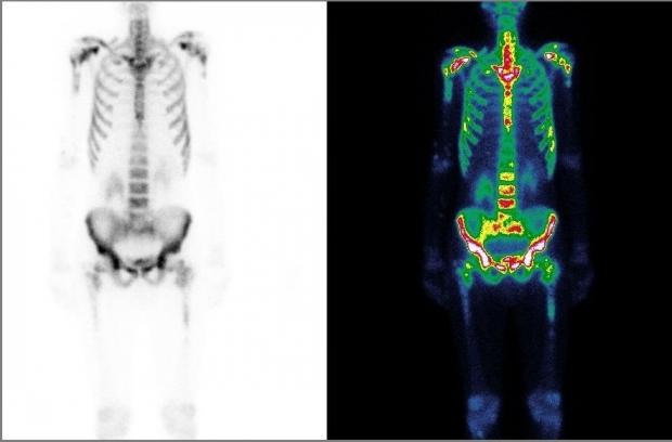 Дифференциальная диагностика цирроза с thumbnail