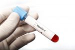 Ложноположительный анализ на гепатит С: ошибочный тест